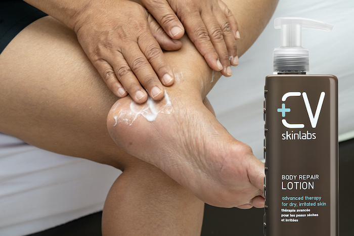 dry skin body repair lotion