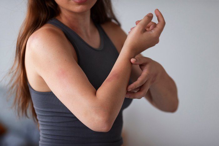 Rashes, Hives, and Redness: How to Deal with COVID Skin Sensitivity