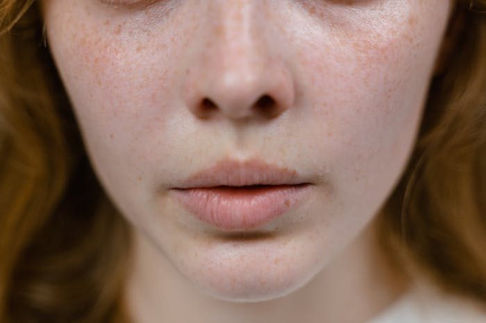 5 Ways to Get Rid of Chapped Lips for Good